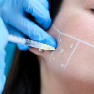 Bótox o Toxina Botulínica bruxismo