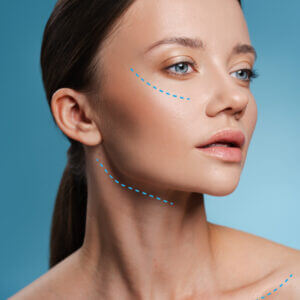 Hydroxyfill + 3 zonas toxina