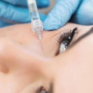 Relleno de ojeras con Ácido Hialurónico